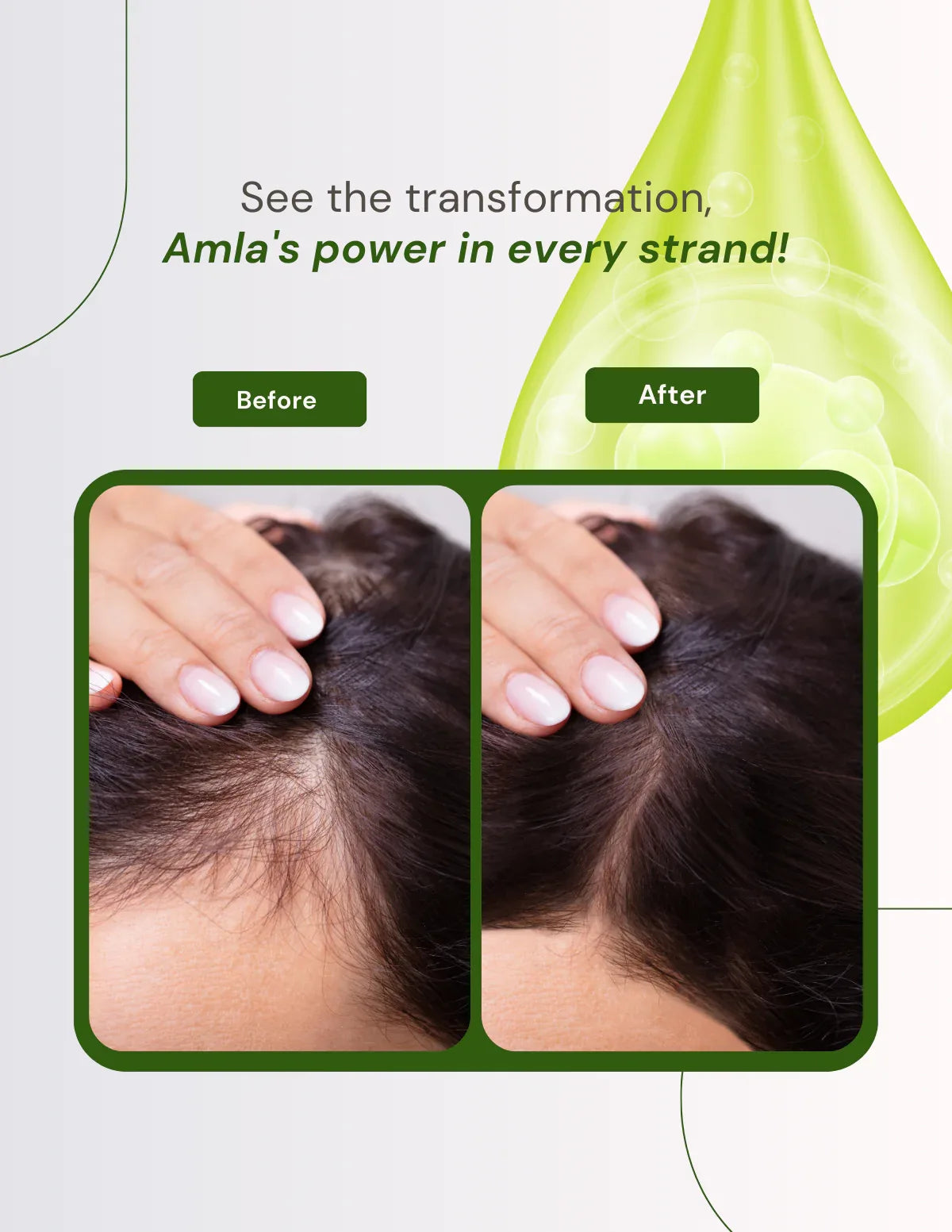 Berg Shampoo Amla - berg.pk