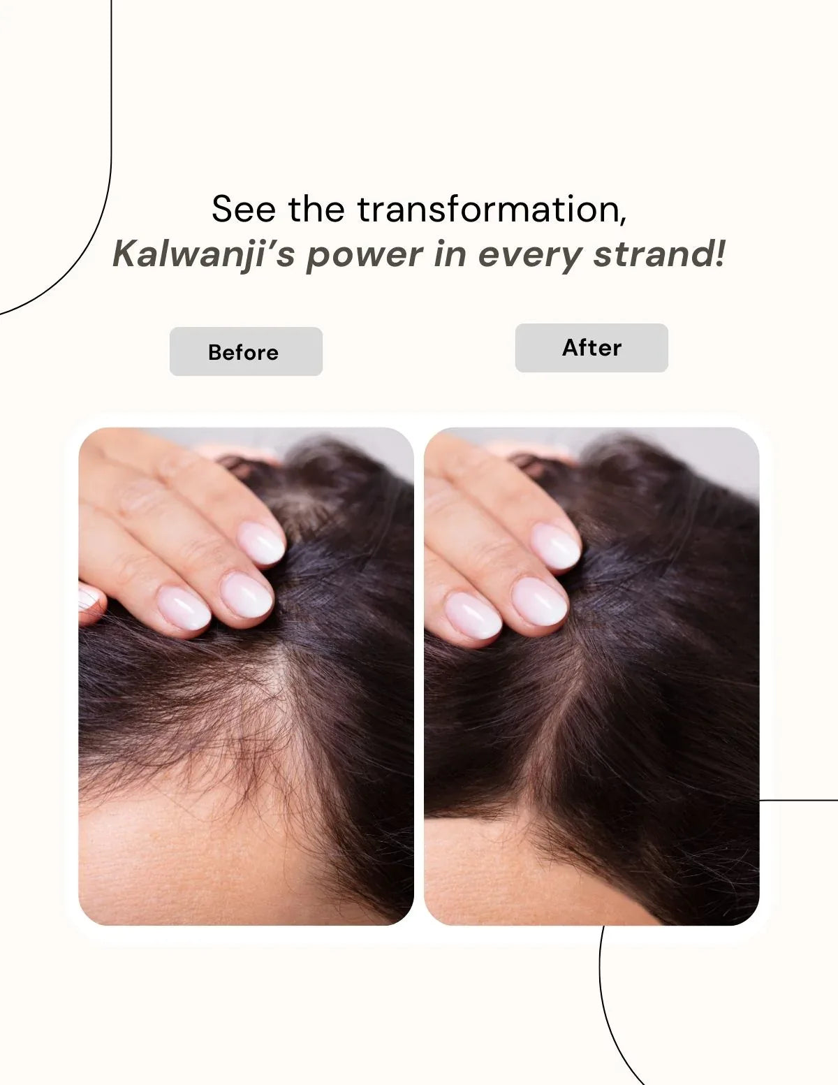 Berg Shampoo Kalwanji - berg.pk