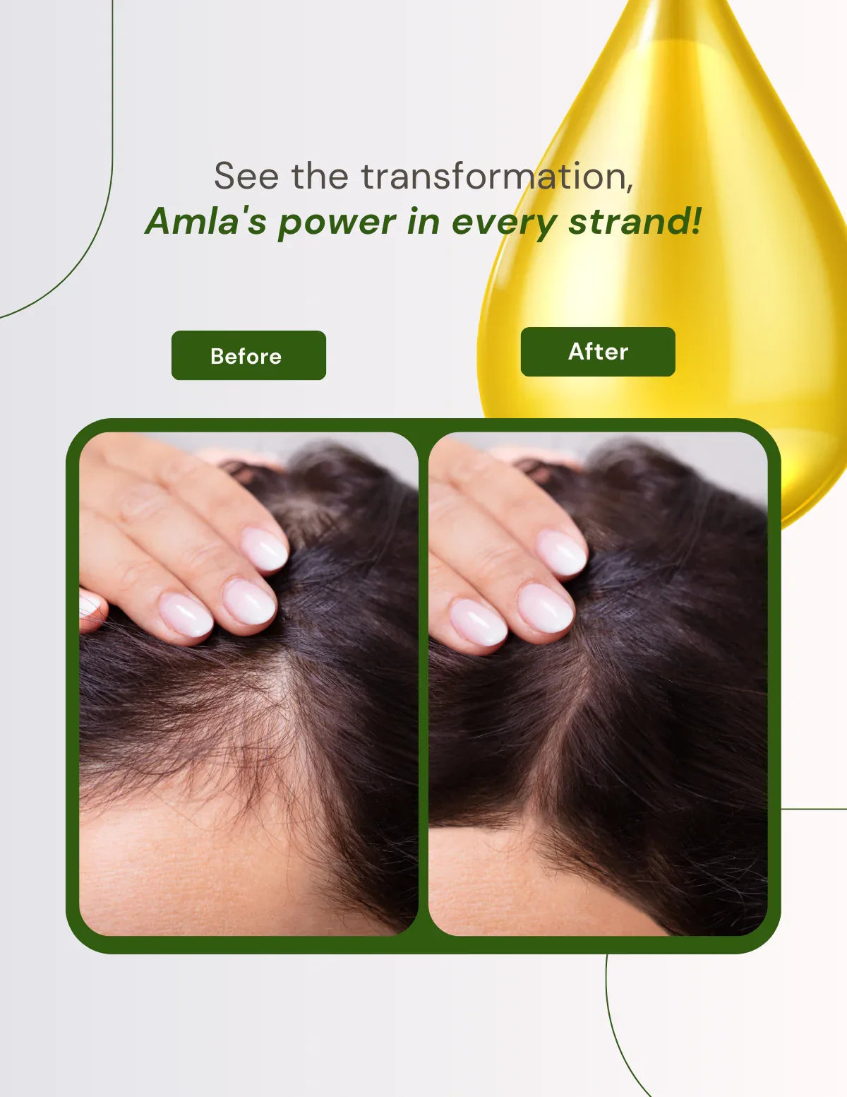Berg Amla Hair Oil - berg.pk
