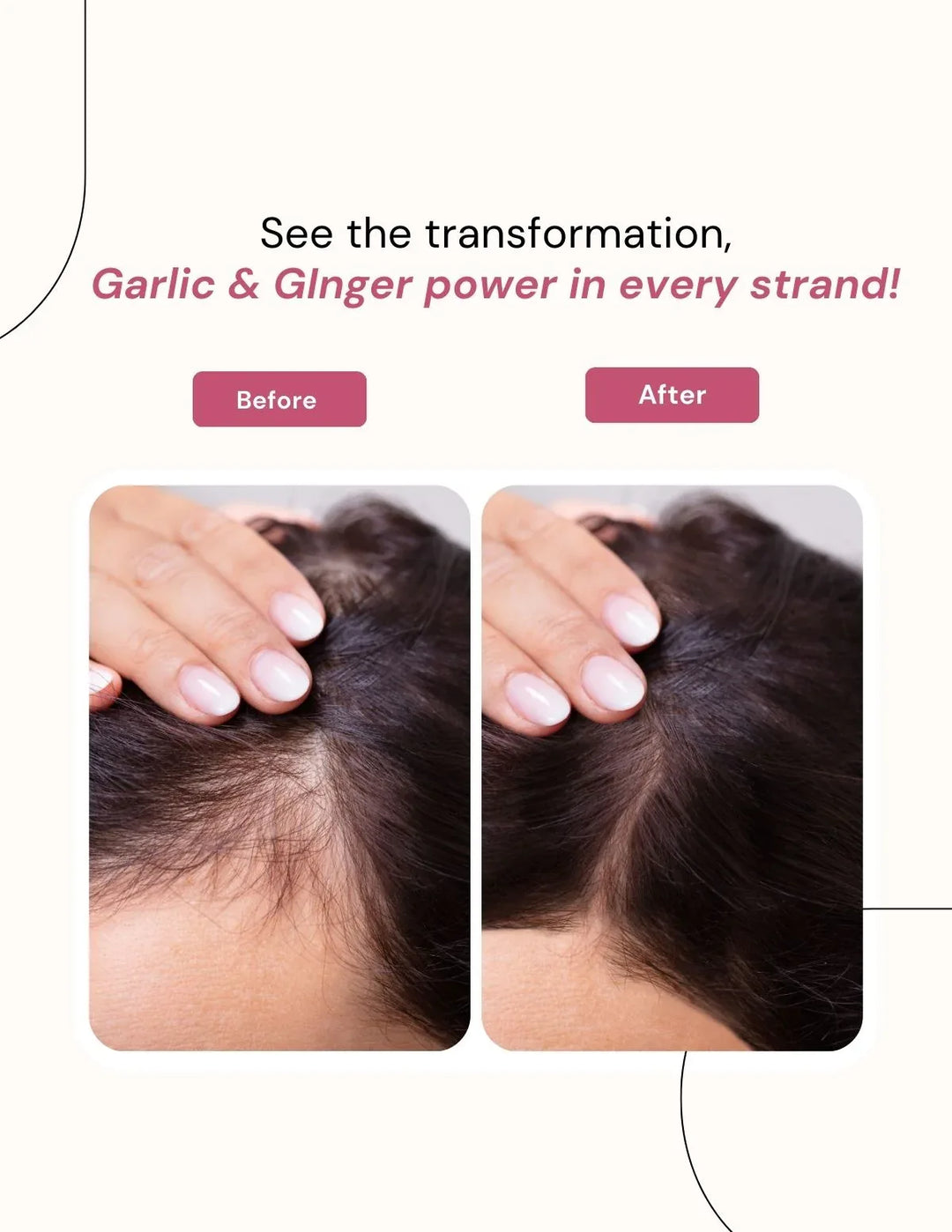 Berg Natural Garlic &amp; Ginger Shampoo - berg.pk