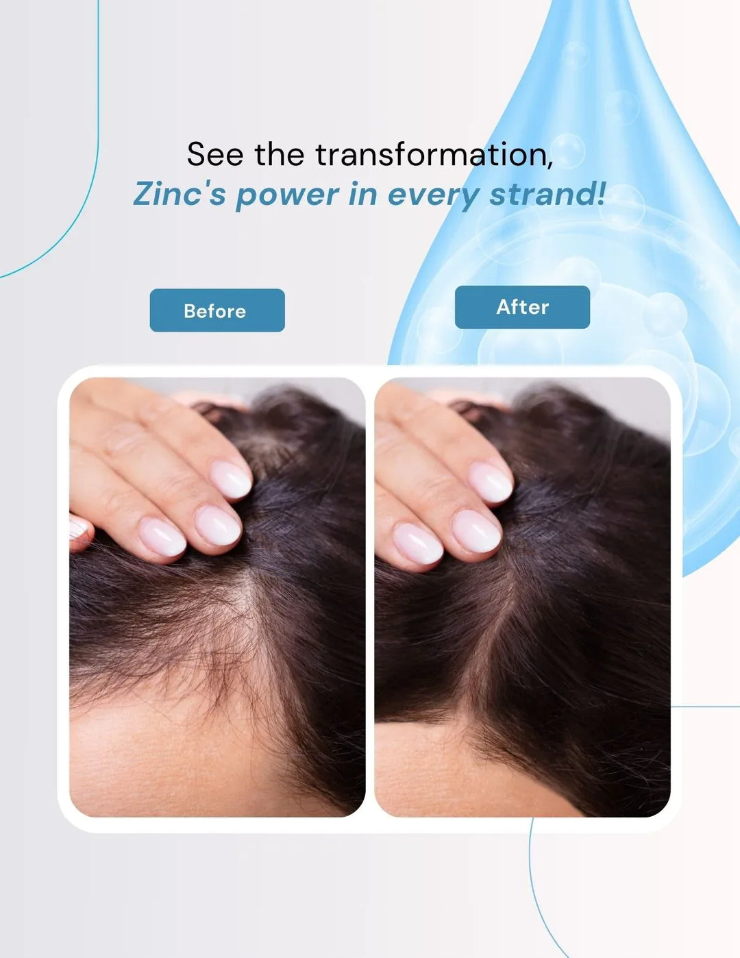 Berg Natural Pyrithione Zinc Shampoo - berg.pk