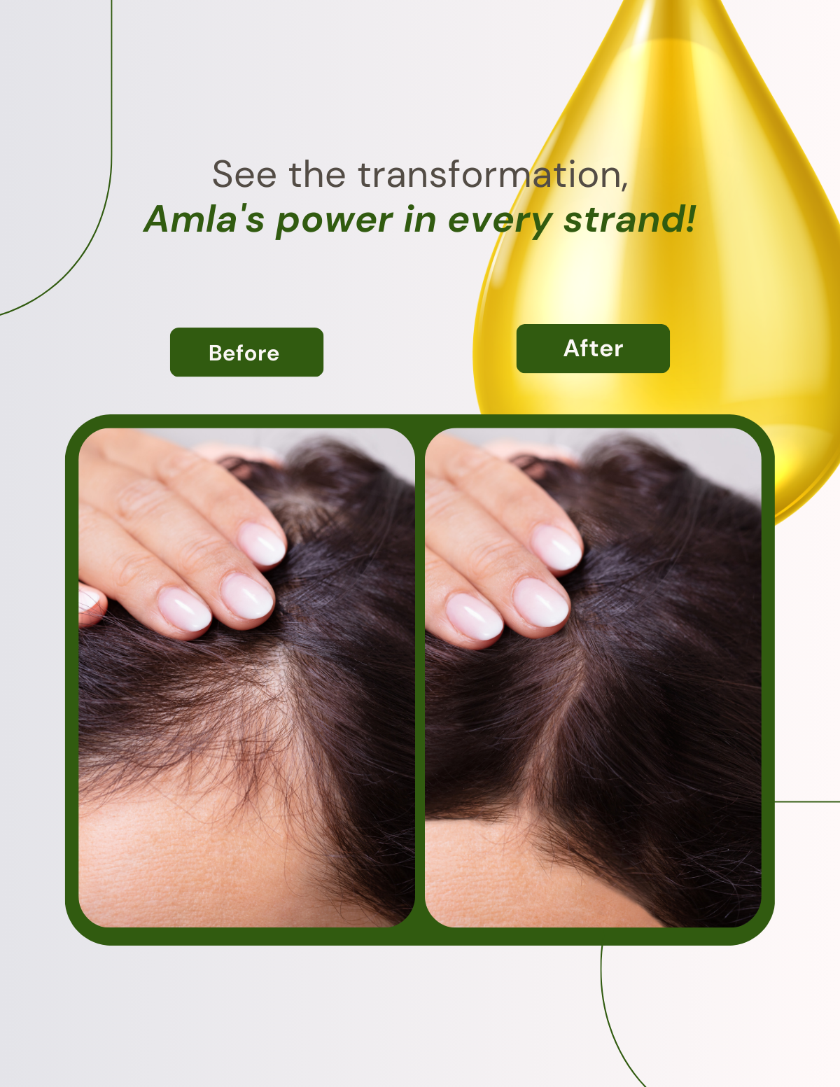 Berg Amla Hair Oil